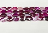 CAA4655 15.5 inches 12*16mm oval banded agate beads wholesale