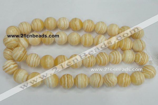 CCA206 15.5 inches 18mm round yellow lace calcite beads