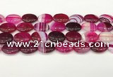 CAA4671 15.5 inches 15*20mm oval banded agate beads wholesale