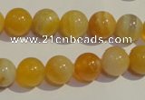 CAA91 15.5 inches 14mm round botswana agate gemstone beads