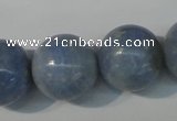 CAG4376 15.5 inches 18mm round dyed blue lace agate beads