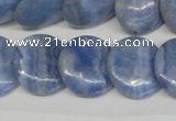 CAG4394 15.5 inches 20mm flat round dyed blue lace agate beads