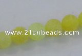 CAG7519 15.5 inches 6mm round frosted agate beads wholesale