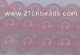 CBC303 15.5 inches 10mm round pink chalcedony beads wholesale