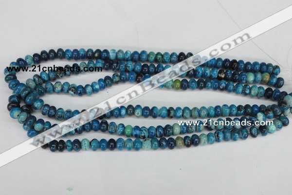 CCO170 15.5 inches 5*8mm rondelle dyed natural chrysotine beads