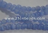 CCT1118 15 inches 2mm round tiny cats eye beads wholesale