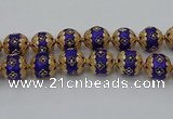 CIB553 22mm round fashion Indonesia jewelry beads wholesale