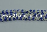 CPB541 15.5 inches 6mm round Painted porcelain beads