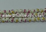 CPB695 15.5 inches 14mm round Painted porcelain beads