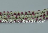 CPB742 15.5 inches 8mm round Painted porcelain beads