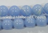 CTU1737 15.5 inches 16mm round synthetic turquoise beads